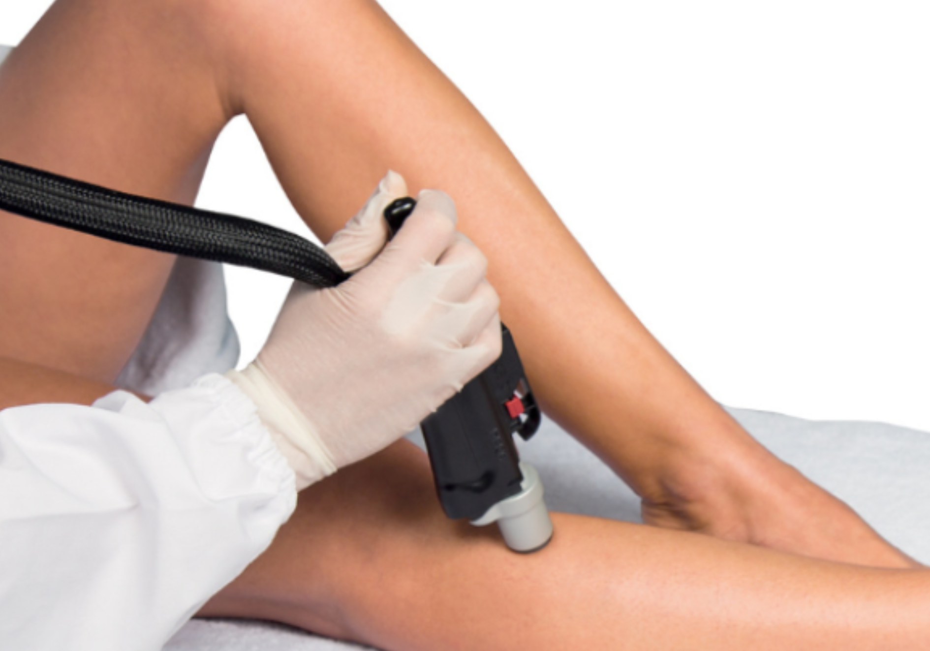Laser Hair Removal